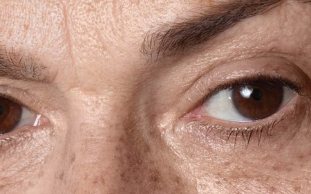 Cosa fa l'anti-invecchiamento al suo viso?