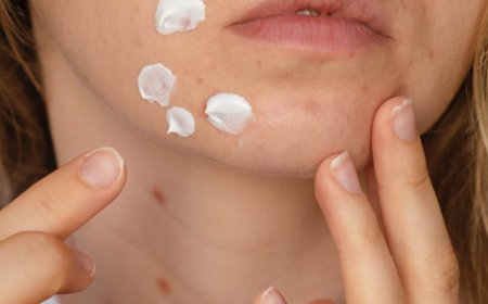Come faccio a sapere se devo smettere di prendere la doxiciclina?