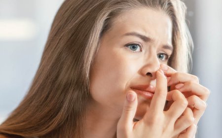 Helpt ijs bij acne?