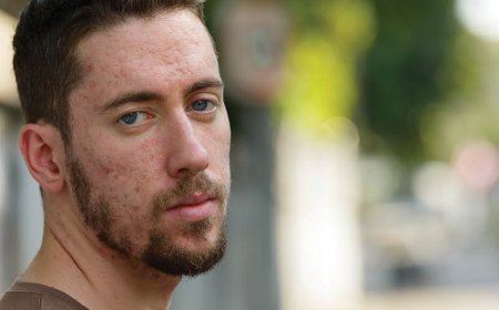 Maakt doxycycline u dikker?
