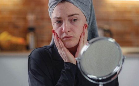 L'acne ha uno scopo?