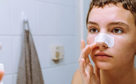 Verwijdert doxycycline bestaande acne?