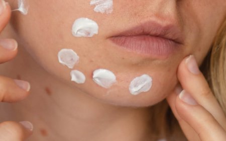 La crema idratante aiuta a combattere l'acne?