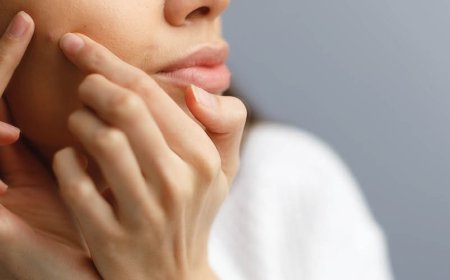 Come posso eliminare l'acne?