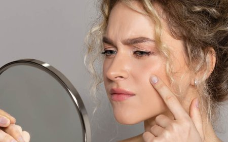 L'acne guarisce da sola?