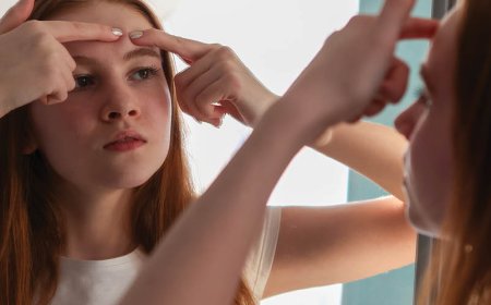 Si può eliminare l'acne cistica?