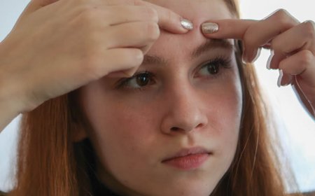 Lo stress causa i brufoli?