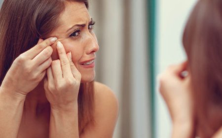 Si può ridurre la doxiciclina per l'acne?