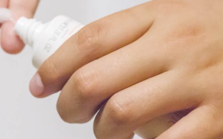 Quanto tempo ci vuole per eliminare completamente l'acne?