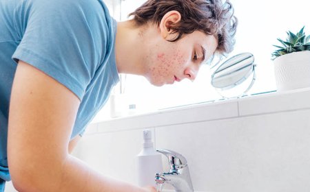 Hoe weet u of uw acne door bacteriën wordt veroorzaakt?