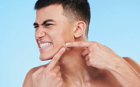 Quanto tempo impiega la doxiciclina a fare effetto?