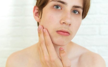 Hoe komt u in een week van acne af?