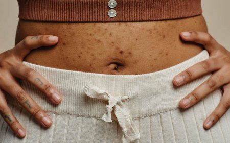 Per quanto tempo si possono assumere antibiotici per l'acne?