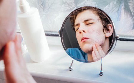 Come si riduce un brufolo cistico durante la notte?