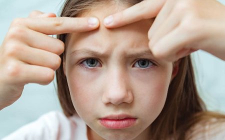 Hoe knapt u een cysteuze puist zonder kop op?