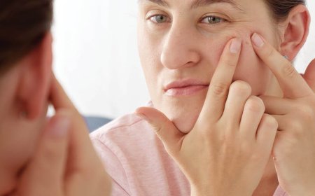 È meglio lasciare un brufolo o farlo scoppiare?