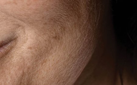 Quali sono i 4 segni di una pelle sana?