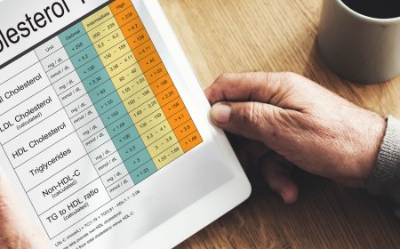 La curcuma fa bene al colesterolo alto?