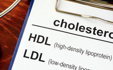 La curcuma riduce il colesterolo?