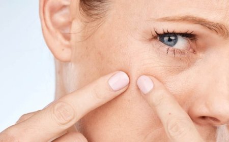 Cosa può peggiorare l'acne?