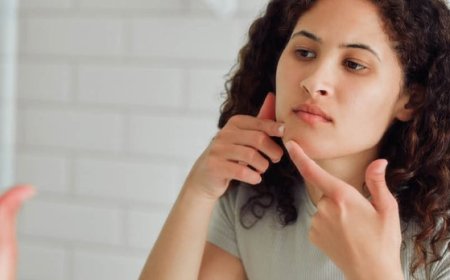 Quali sono i segni che l'acne sta guarendo?