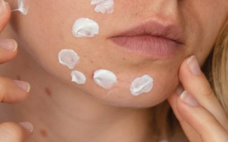 Quali sono i 7 tipi di acne?
