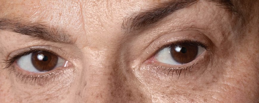 Quels sont les effets de l'anti-âge sur votre visage ?