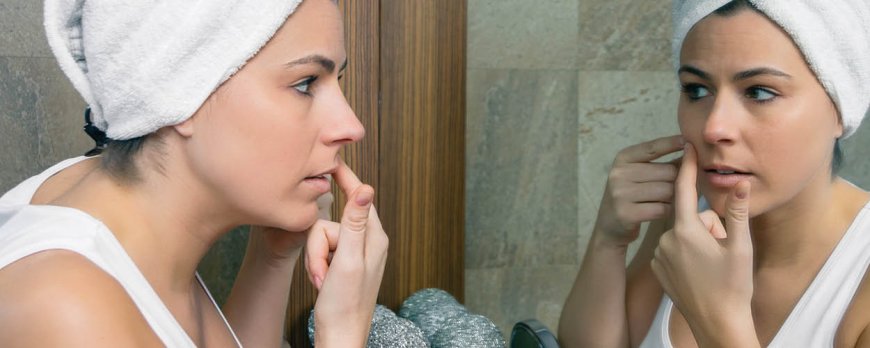 Does acne mean hormonal imbalance?