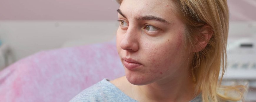 Kan angst acne veroorzaken?