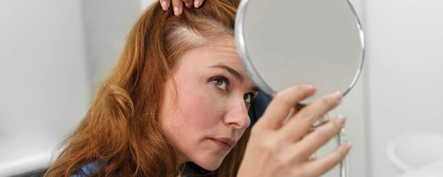 Troppo magnesio può causare la perdita di capelli?