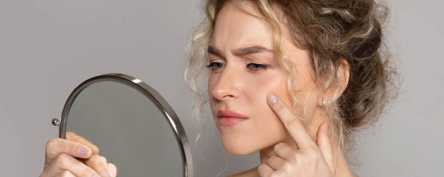 Does acne heal on its own?