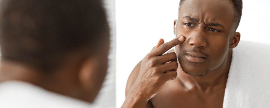 Faut-il faire disparaître l'acné ?
