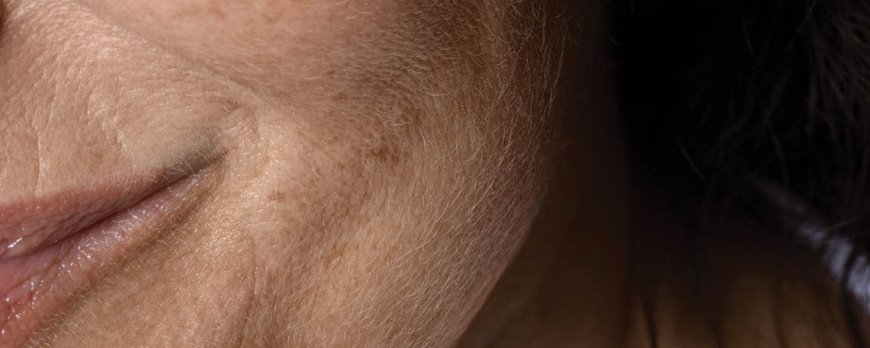 Quels sont les 4 signes d'une peau saine ?