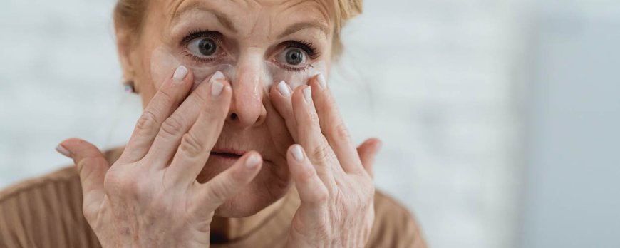 Natural Remedies for Flawless Skin