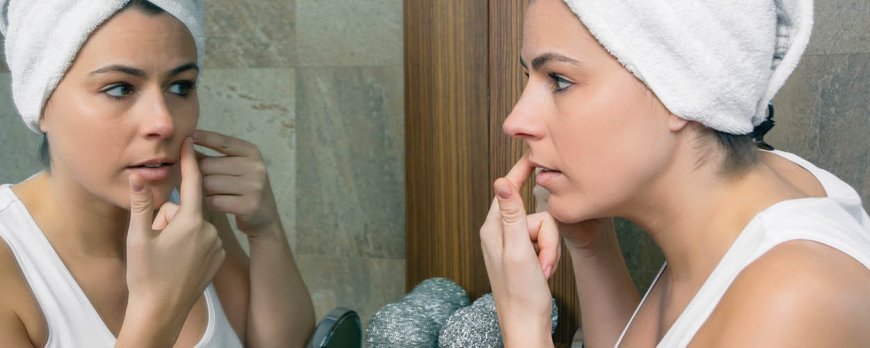 Cosa può essere scambiato per acne cistica?
